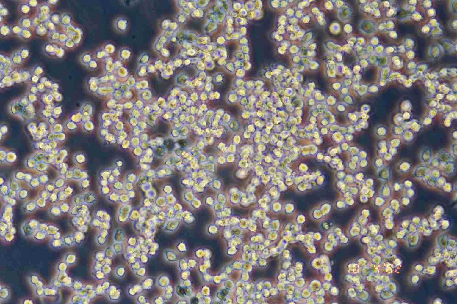 COLO 320HSR细胞图片